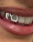 Dent pleine + contour