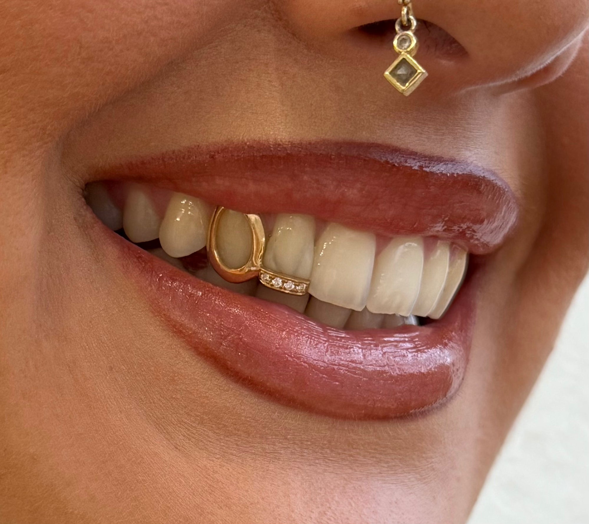Dent pleine + une ligne