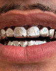 Dent pleine ou contour