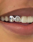 Dent pleine + contour